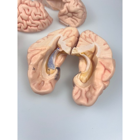 Vintage Somso Germany Anatomical Teaching Model | Human Brain | 6 Parts | Oddity - Picture 7 of 9